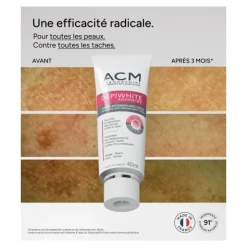 ACM Dépiwhite Advanced crème