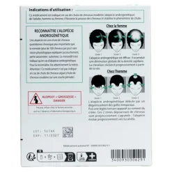 Alopexy minoxidil 2 % solution