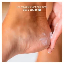 Alvadiem Crème anti callosités