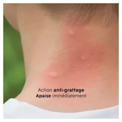 Alvadiem Gel apaisant piqures