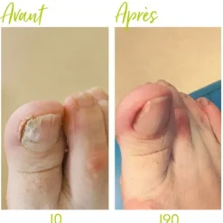 Alvadiem Soin ongles assainissant
