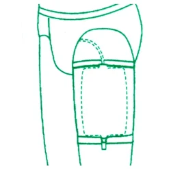 B Braun Urimed Fix porte-poche ambulatoire par 2