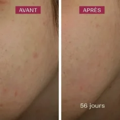 Biarritz Sérum anti taches