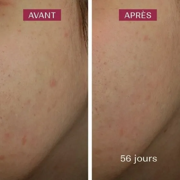 Biarritz Sérum anti taches