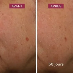 Biarritz Sérum anti taches