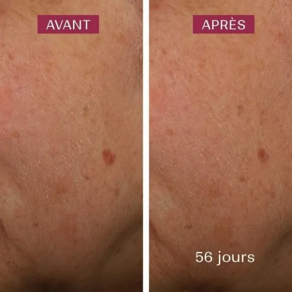 Biarritz Sérum anti taches