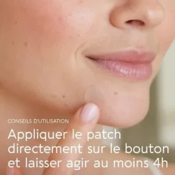 Bioctye Active Pimple Patch anti boutons