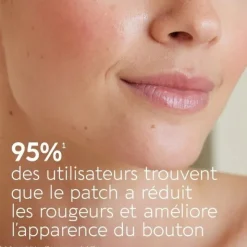 Bioctye Active Pimple Patch anti boutons