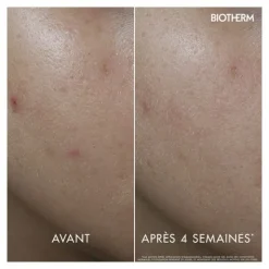 Biotherm Aquasource Vitamin Glow gel
