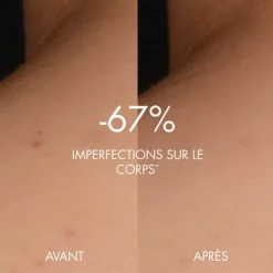 Biotherm biocorps sérum corps peeling peau neuve