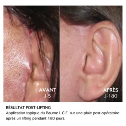 Cebelia baume LCE