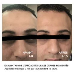 Cebelia Eclaircissant Yeux Cernes pigmentés