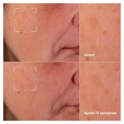 Clinique even better clinical sérum illuminateur anti taches