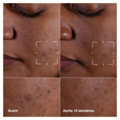 Clinique even better clinical sérum illuminateur anti taches