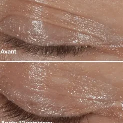 Clinique Smart Clinical Crème yeux correction rides