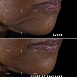 Clinique Smart Clinical Repair Crème liftante visage + cou