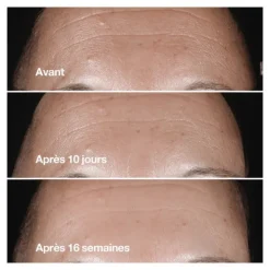 Clinique Smart clinical repair Sérum correcteur anti rides