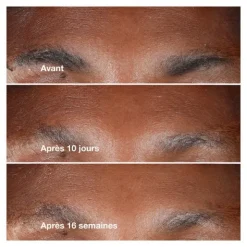 Clinique Smart clinical repair Sérum correcteur anti rides