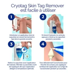 Cryotag Skin Tag Remover Traitement des acrochordons