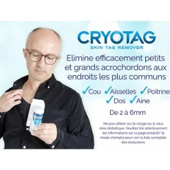 Cryotag Skin Tag Remover Traitement des acrochordons