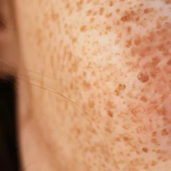 Cytolnat Kojic Crème éclat anti-taches