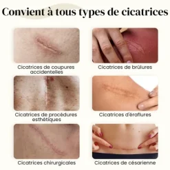 Dermatix gel silicone cicatrice