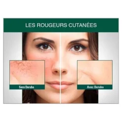 Deruba crème anti-rougeurs SPF 50+