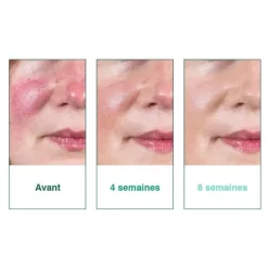 Deruba crème anti-rougeurs SPF 50+