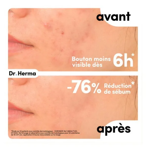 Dr Herma Patch anti boutons format Large