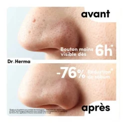 Dr Herma Patch anti boutons​ formats assortis