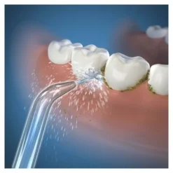 Embout pour hydropulseur Waterpik