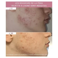 Etat pur Enoxolone 2%
