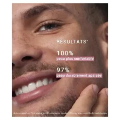 Etat pur Enoxolone 2%