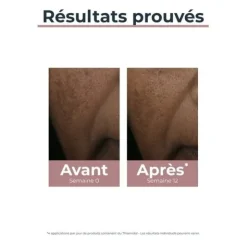 Eucerin Anti Pigment correcteur de taches