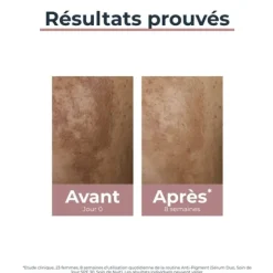 Eucerin Anti Pigment Serum Duo