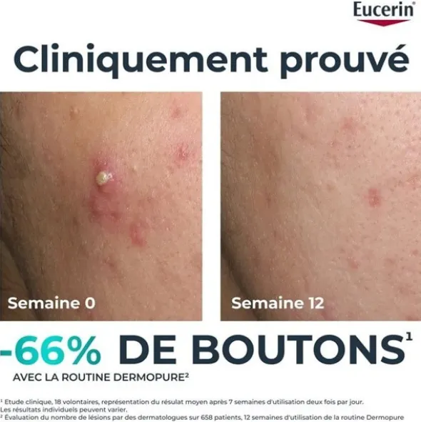 Eucerin DermoPure Fluide Triple correction