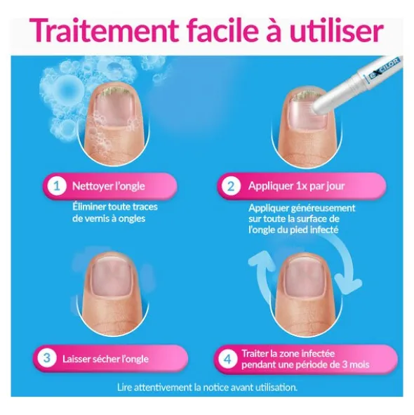 Excilor Easy mycose ongle stylet