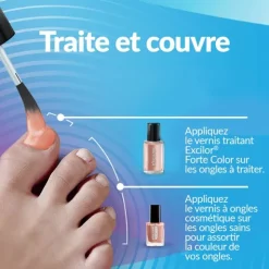 Excilor Forte Color vernis mycose ongle
