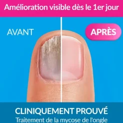 Excilor Forte solution filmogène