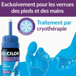 Excilor Verrue traitement par cryothérapie