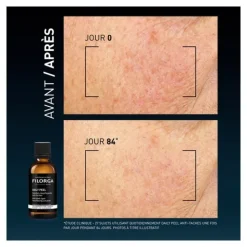 Filorga Daily Peel Solution resurfaçante anti taches