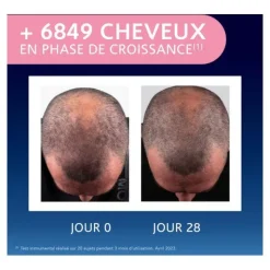 Forcapil Elixir croissance