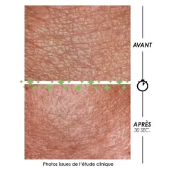 Garancia Pschitt magique Nouvelle peau