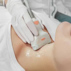 Gel de contact lubrifiant Supragel