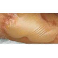 Hartmann Hydrocoll Thin pansement hydrocolloide