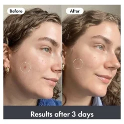 Hero Baume hydratant réparateur post imperfections