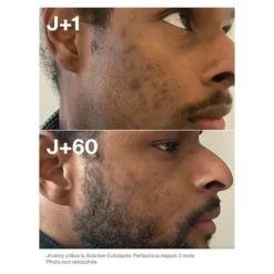 Horace Solution exfoliante perfectrice