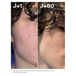 Horace Solution exfoliante perfectrice