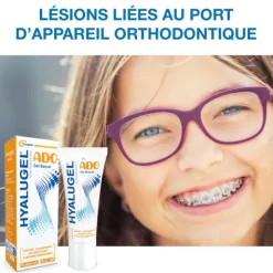 Hyalugel Ado gel buccal
