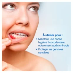 Hyalugel Forte Perio spray buccal